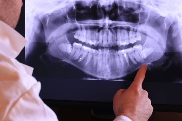 Best Cracked Tooth Emergency Dentist  in Closter, NJ